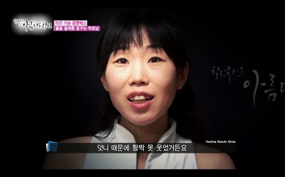 이현정원장의 아름다운 당신 시즌 1(4회 박효남 도전자) 돌출입 치아교정 관련 이미지 3