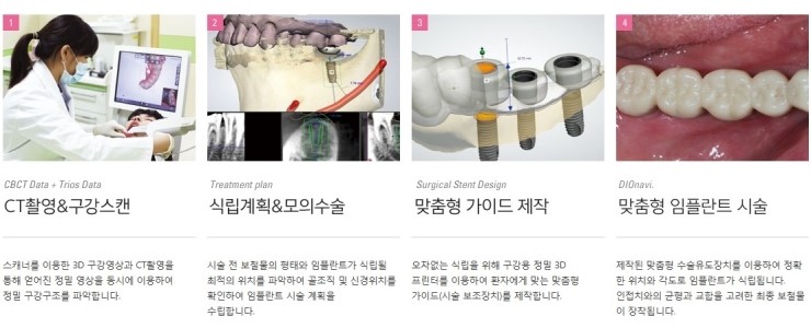 임플란트 보험적용 본인부담 50% 관련 이미지 5