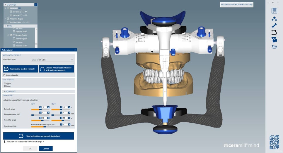 [신논현 치과] 3D 구강 스캐너_정확하게 본뜨기 관련 이미지 6