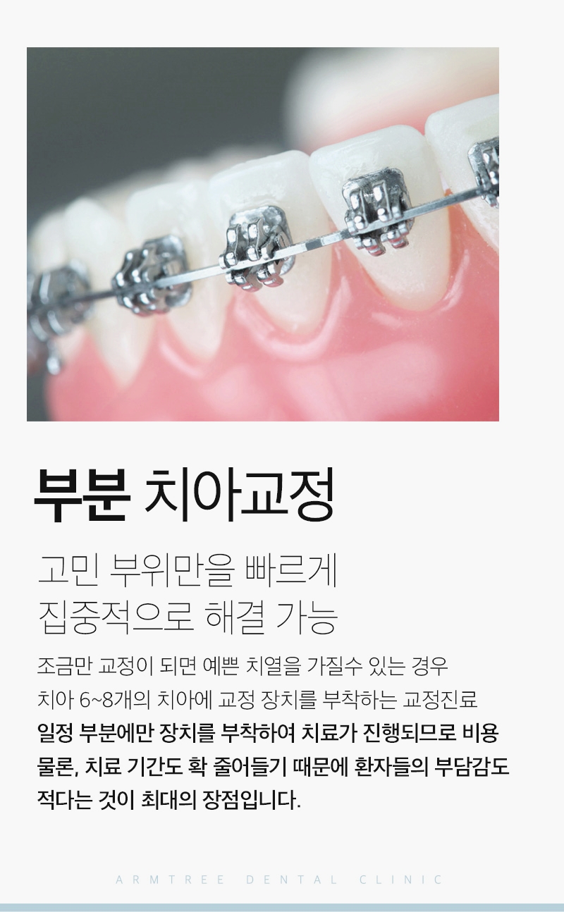 부분교정기간 단기간에 신논현 아름드리치과 관련 이미지 3