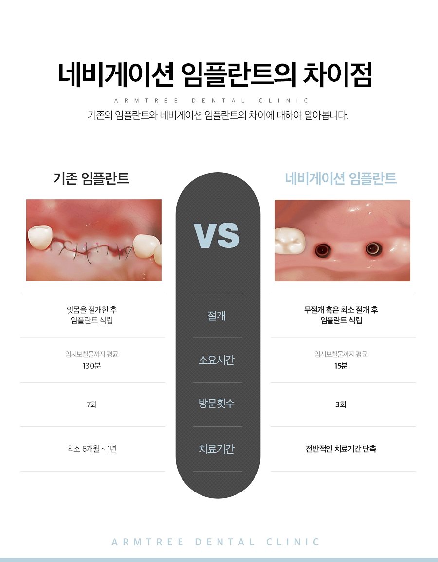 앞니임플란트 자연스러움을 원한다면 관련 이미지 4