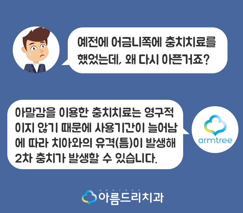 충치인레이 아말감주변 충치치료는? 관련 이미지 3