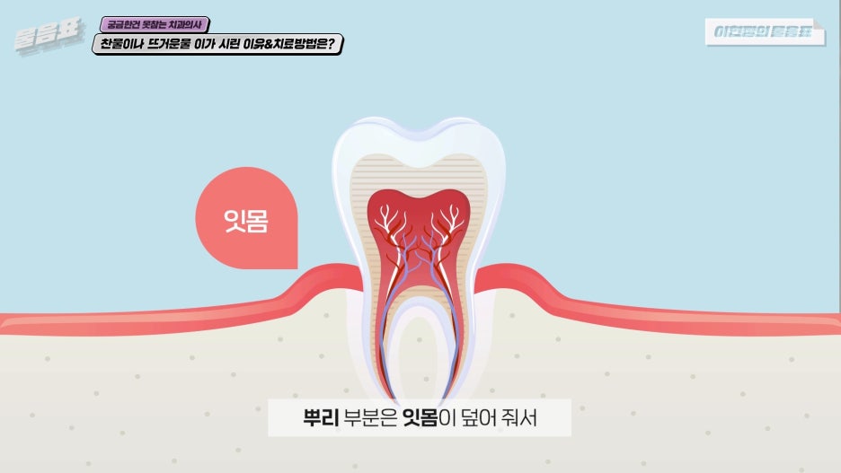 찬물 뜨거운물 이시림 원인! 이가 시린이유 아름드리치과 관련 이미지 4