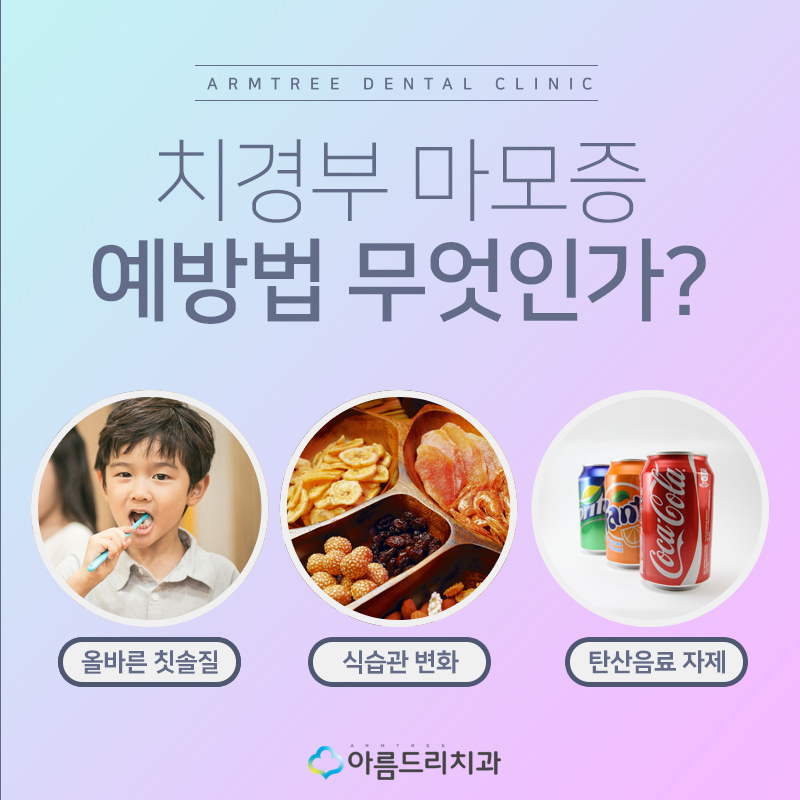 시린이 이시림치료 치경부마모증 관련 이미지 8