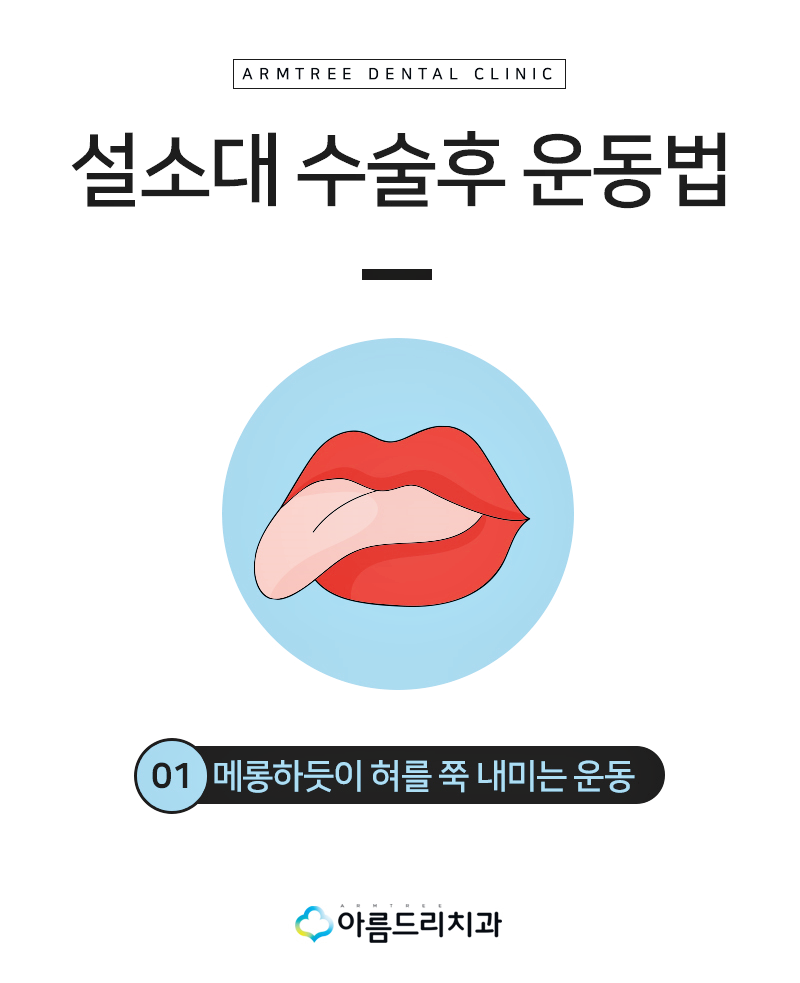 설소대단축증 - 단설소대증의 치료과정 관련 이미지 10