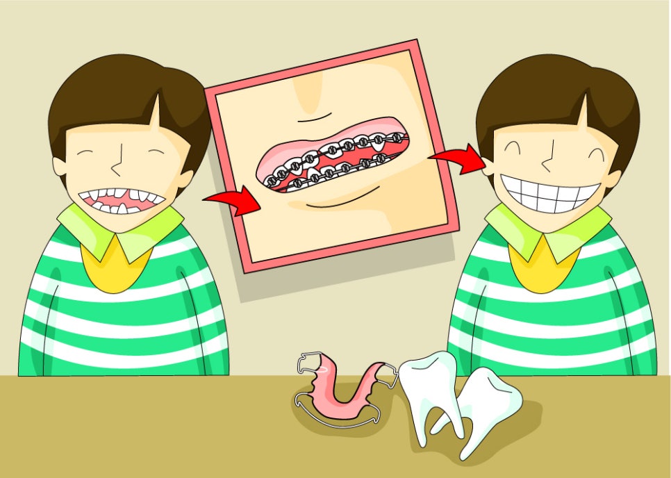 아름드리치과 이현정원장의 어린이 치아교정 이야기(2009년 11월 30일 OSEN 기사 내용) 관련 이미지 2