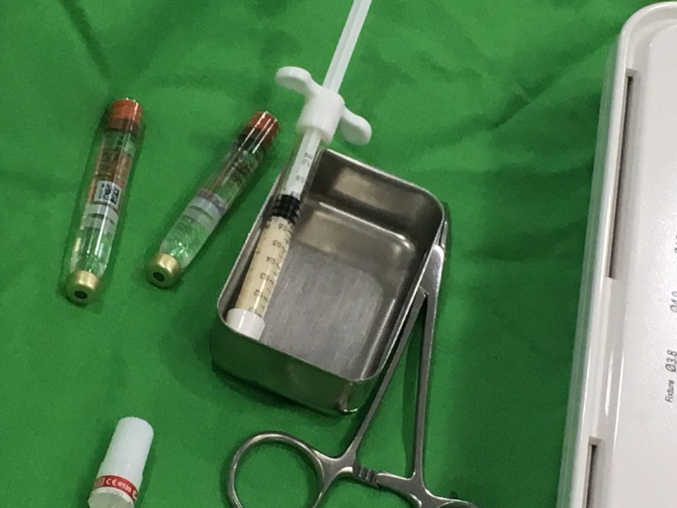 앞니 임플란트_뼈이식_신논현역 치과_아름드리 치과 관련 이미지 10