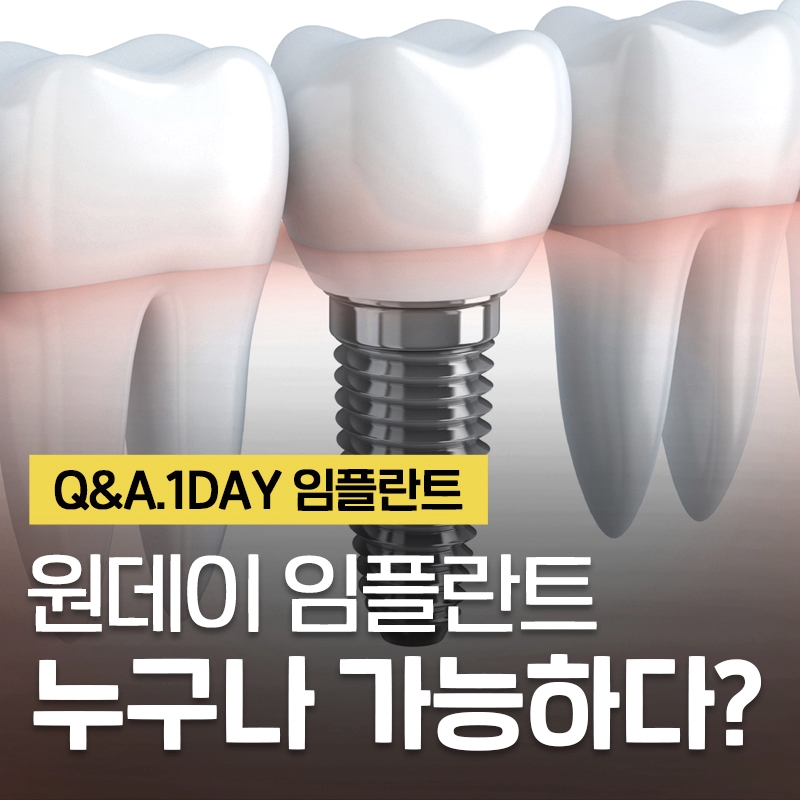 원데이임플란트 누구나 가능하다? #이현정의물음표 관련 이미지 1
