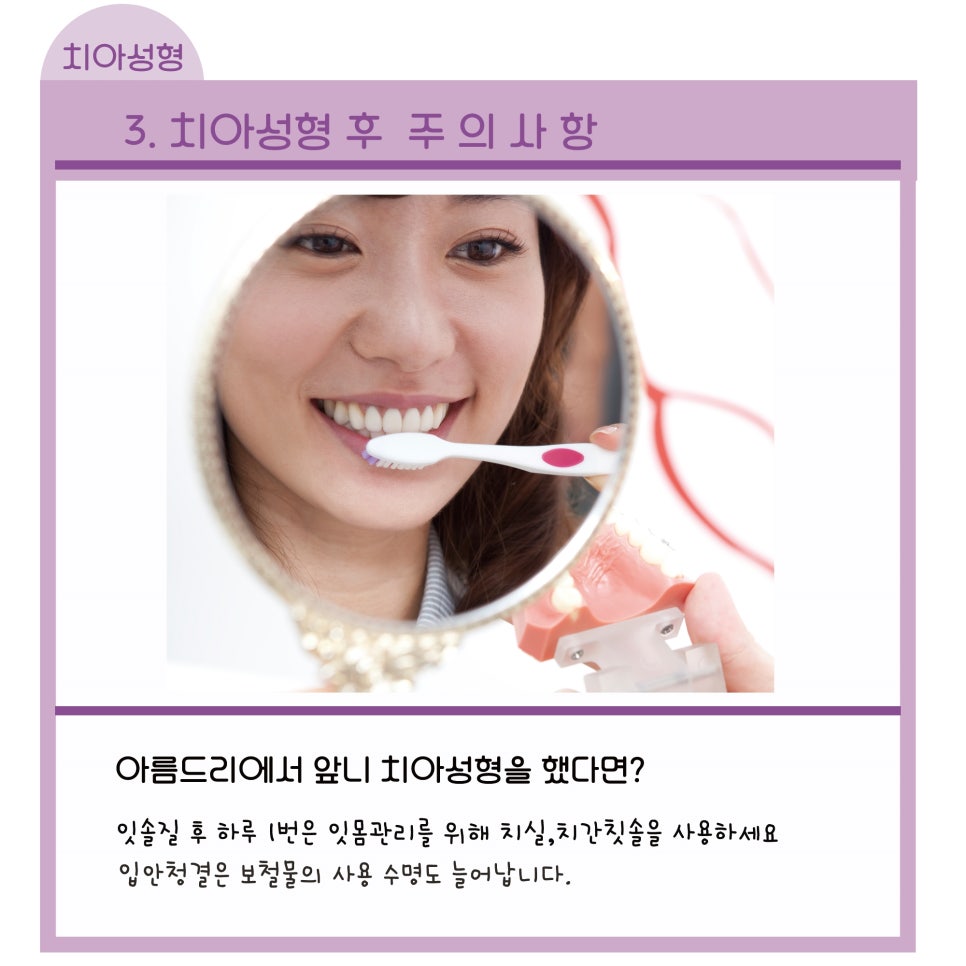 라미네이트,올세라믹으로 연예인치아 (주의사항)_아름드리치과 관련 이미지 18