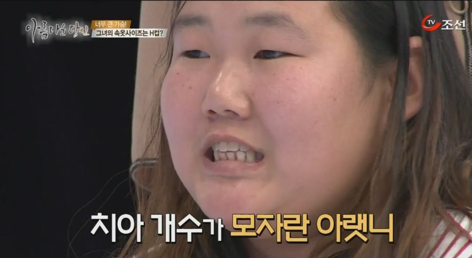 이현정원장의 아름다운 당신 시즌 2 (8회 최은경 도전자) 치아교정, 임플란트, 치아미백 관련 이미지 4