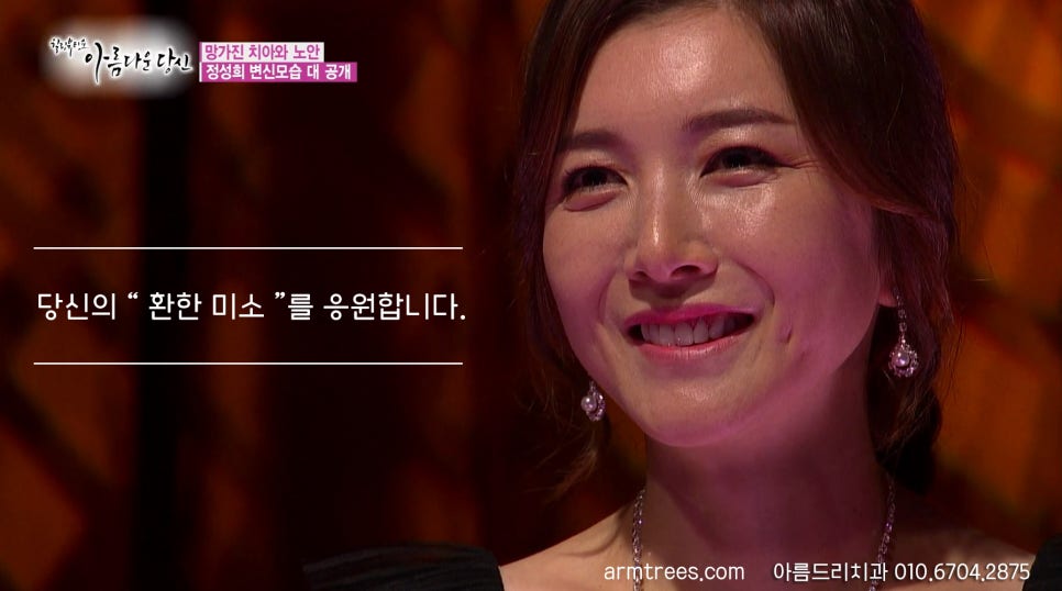 이현정 원장의 아름다운 당신 시즌 1 (8회 정성희 도전자) 임플란트, 신경치료, 치아성형, 올세라믹, 치아미백, 화이트랩스 관련 이미지 6