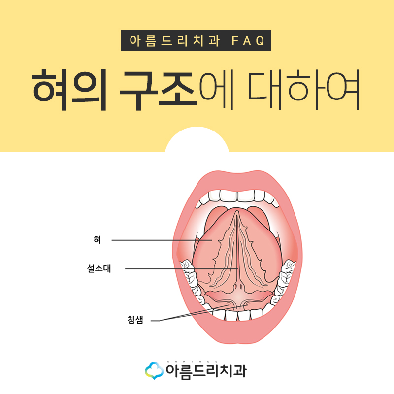 성인설소대수술 단축증치료 아름드리치과 관련 이미지 2