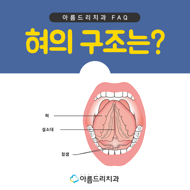 성인설소대수술 혀유착증 강남 바로알기 관련 이미지 5