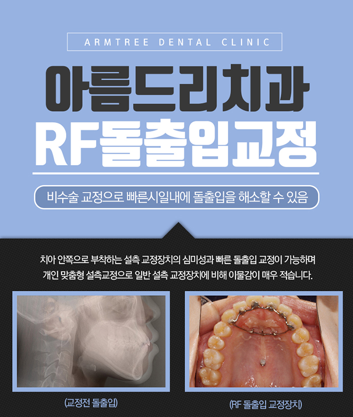치아교정얼굴변화 어떠한가? 관련 이미지 7