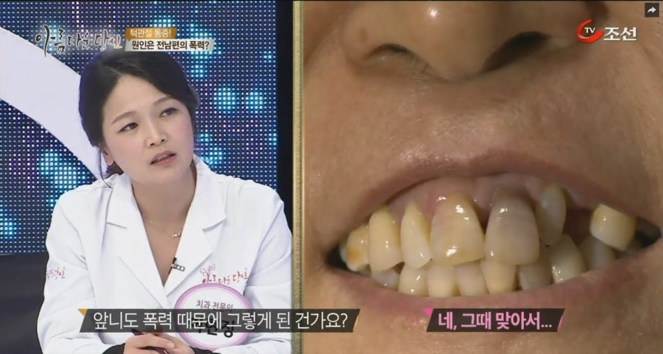 이현정원장의 아름다운 당신 시즌 2 (8회 윤해숙 도전자) 치주치료, 충치치료, 원데이 임플란트, 네비게이션 임플란트, 돌출입 심미보철, 치아미백, 스마일 트레이닝 관련 이미지 3