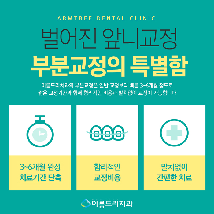 앞니 벌어짐 교정 빠른해결책 관련 이미지 7