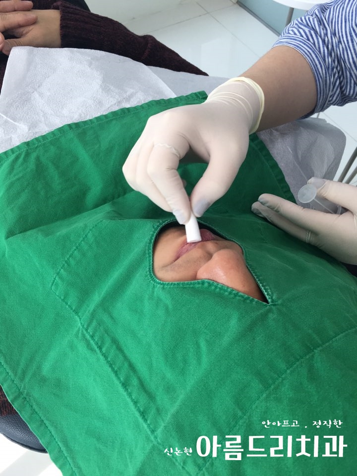 신논현역치과 아름드리치과에서 건강한 치아미백, 전문가 미백 관련 이미지 2