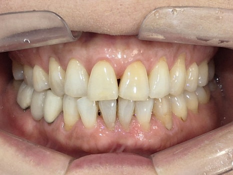 테일러 비니어 (진료일기) 관련 이미지 6