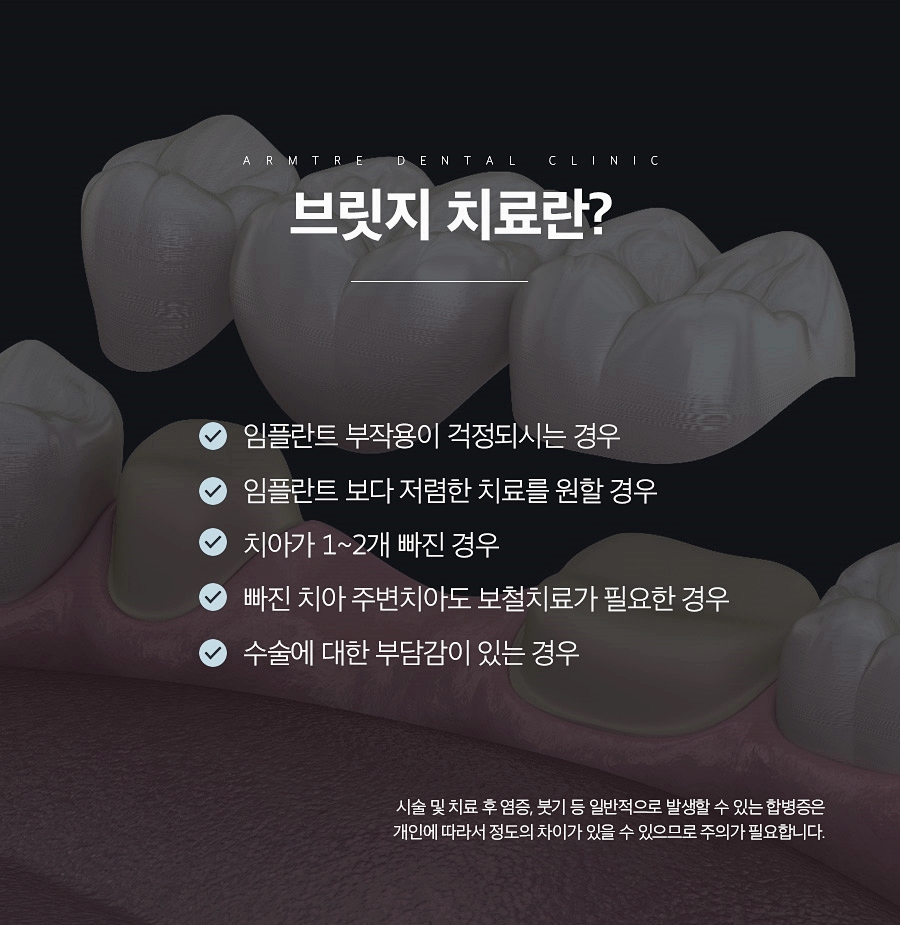 치아브릿지 가격 신논현역 아름드리치과 관련 이미지 4