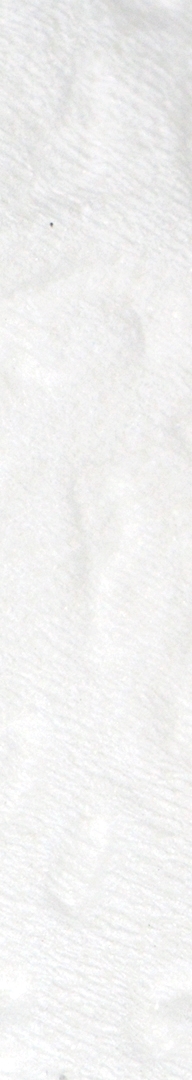 신논현치과 사랑니발치 치과는 신중하게 관련 이미지 6