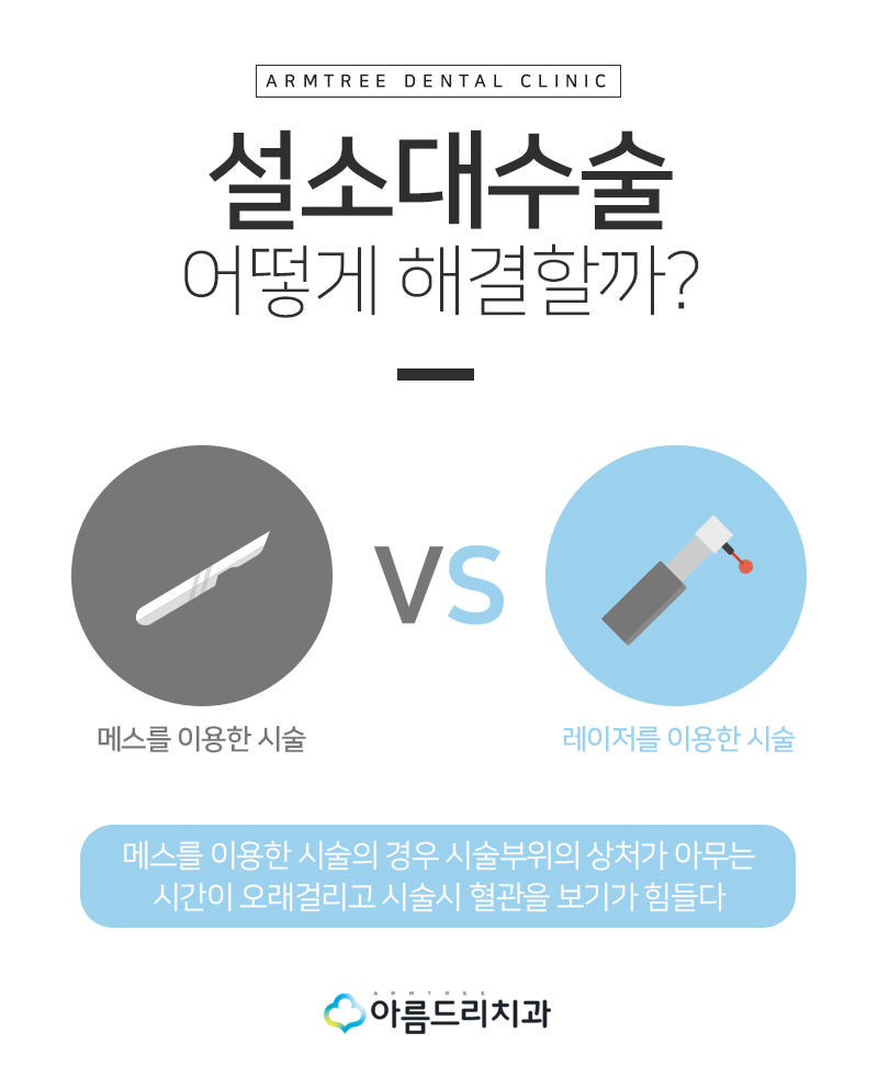 설소대수술 - 실제후기로 보는 확연한 차이 관련 이미지 6
