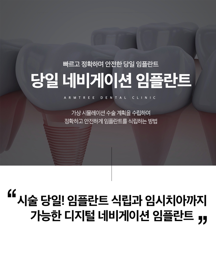 디지털임플란트 당일임플란트로 정확하고 안전하다면 관련 이미지 1