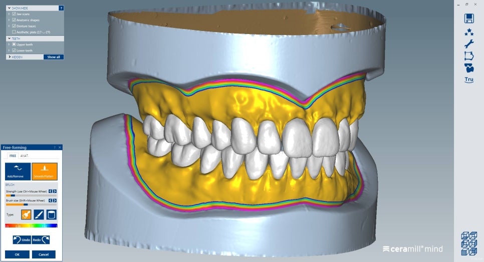 [신논현 치과] 3D 구강 스캐너_정확하게 본뜨기 관련 이미지 8
