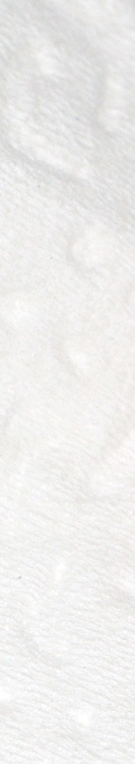 신논현치과 사랑니발치 치과는 신중하게 관련 이미지 7