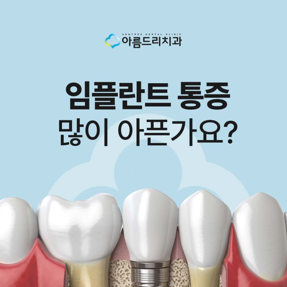 강남 임플란트 시술 후 통증 원인, 통증 줄이는 방법, 주의사항 관련 이미지 1
