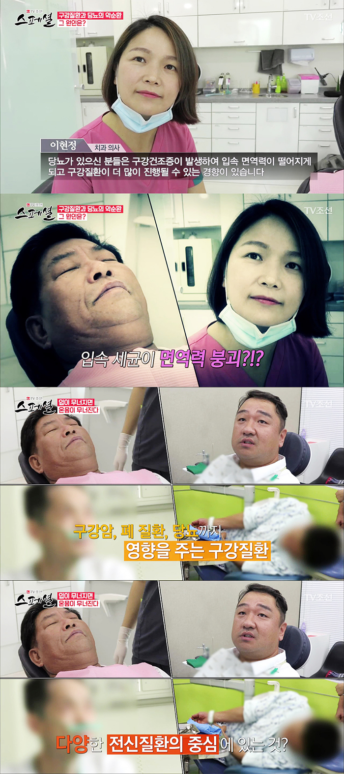 TV조선 스페셜 50회 구강건강관리 관련 이미지 8