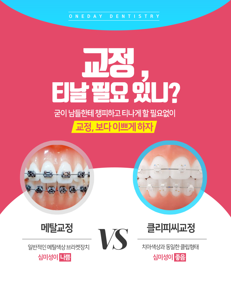 클리피시교정 후기와 기간 궁금해? 관련 이미지 4
