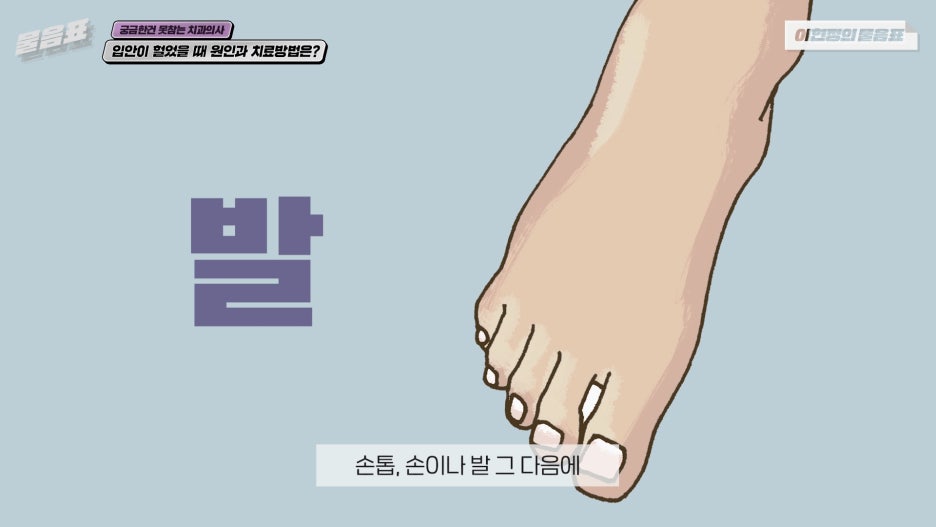 입안이 헐었을때 해결방법 이현정의물음표 관련 이미지 7