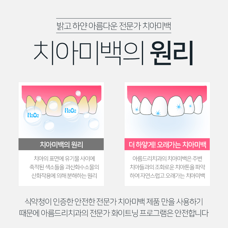 연예인치아미백 치과 하얀이빨로 관련 이미지 3