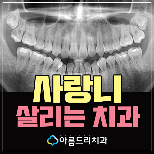 신논현역치과 사랑니 꼭 빼야하나요? 관련 이미지 1