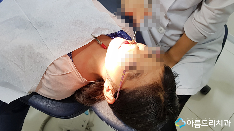 어린이치아교정 부정교합 리얼스토리#2 관련 이미지 10