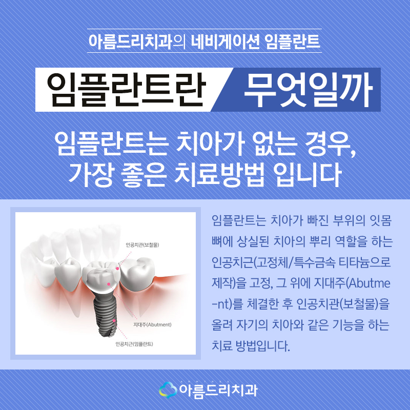 컴퓨터분석임플란트 잘하는 아름드리치과 관련 이미지 2