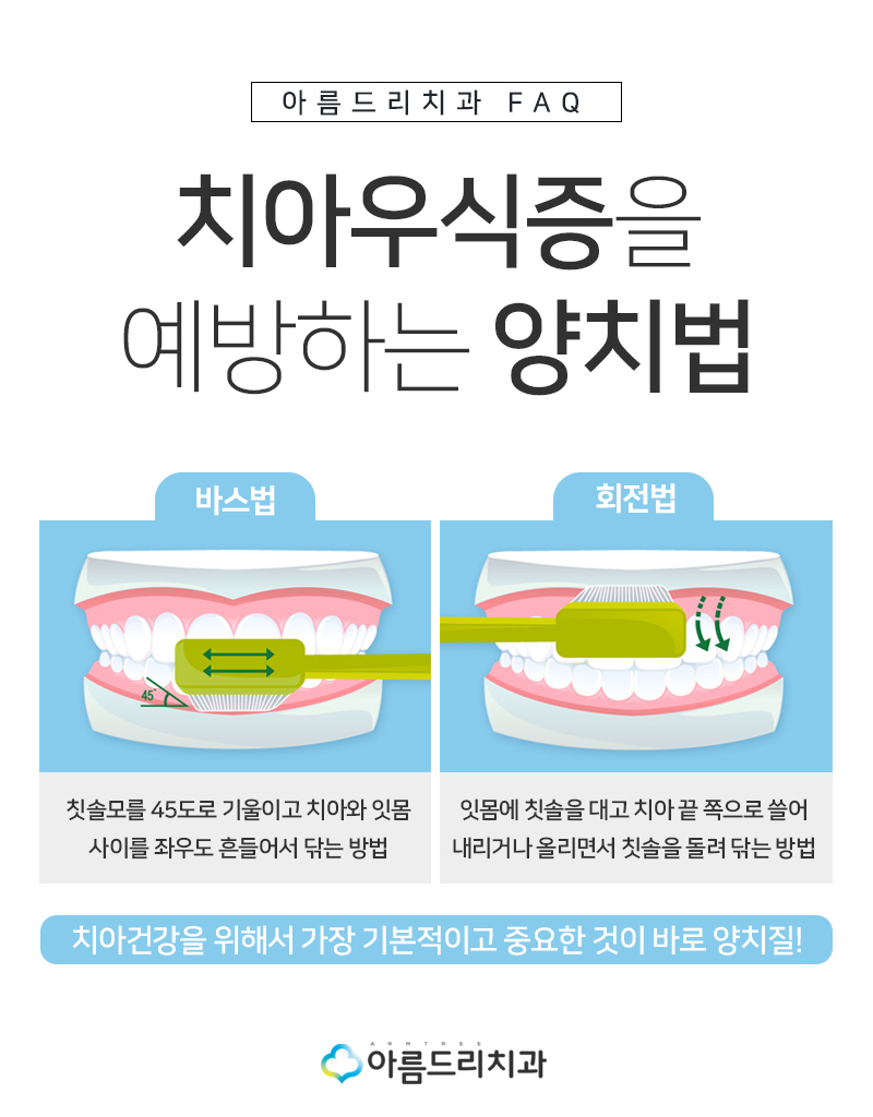 치아우식증 어금니충치 재충치치료 관련 이미지 8