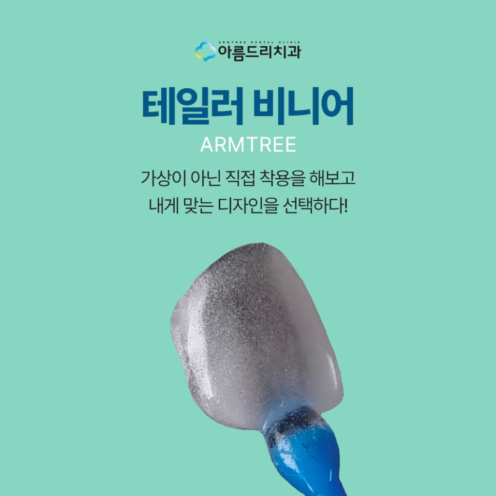 하루 2명만 받을 수 있는 정밀 치료 테일러 비니어란?! 관련 이미지 1