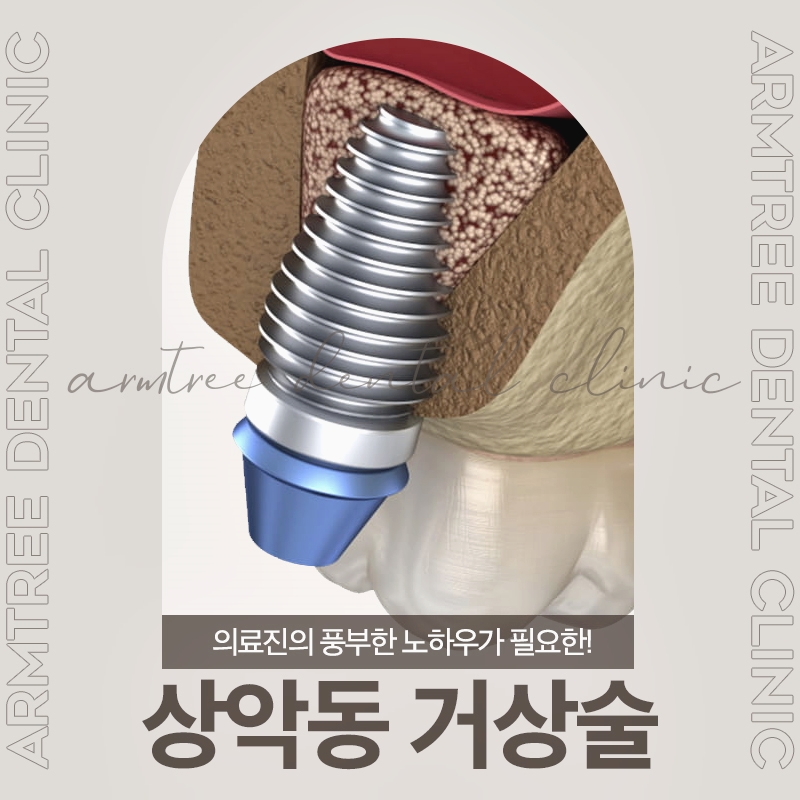 신논현역 상악동거상술 임플란트 아름드리치과는 관련 이미지 1
