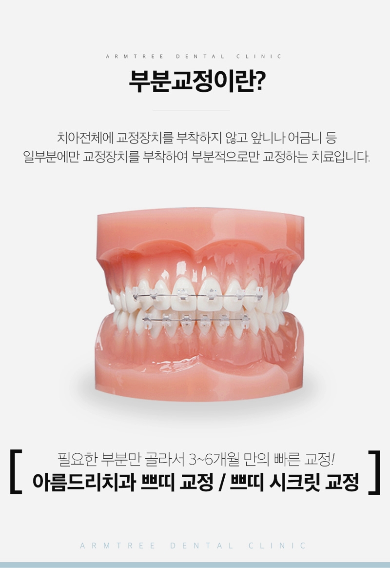 벌어진앞니부분교정 후기로 아름드리치과에서 자신감찾기 관련 이미지 4