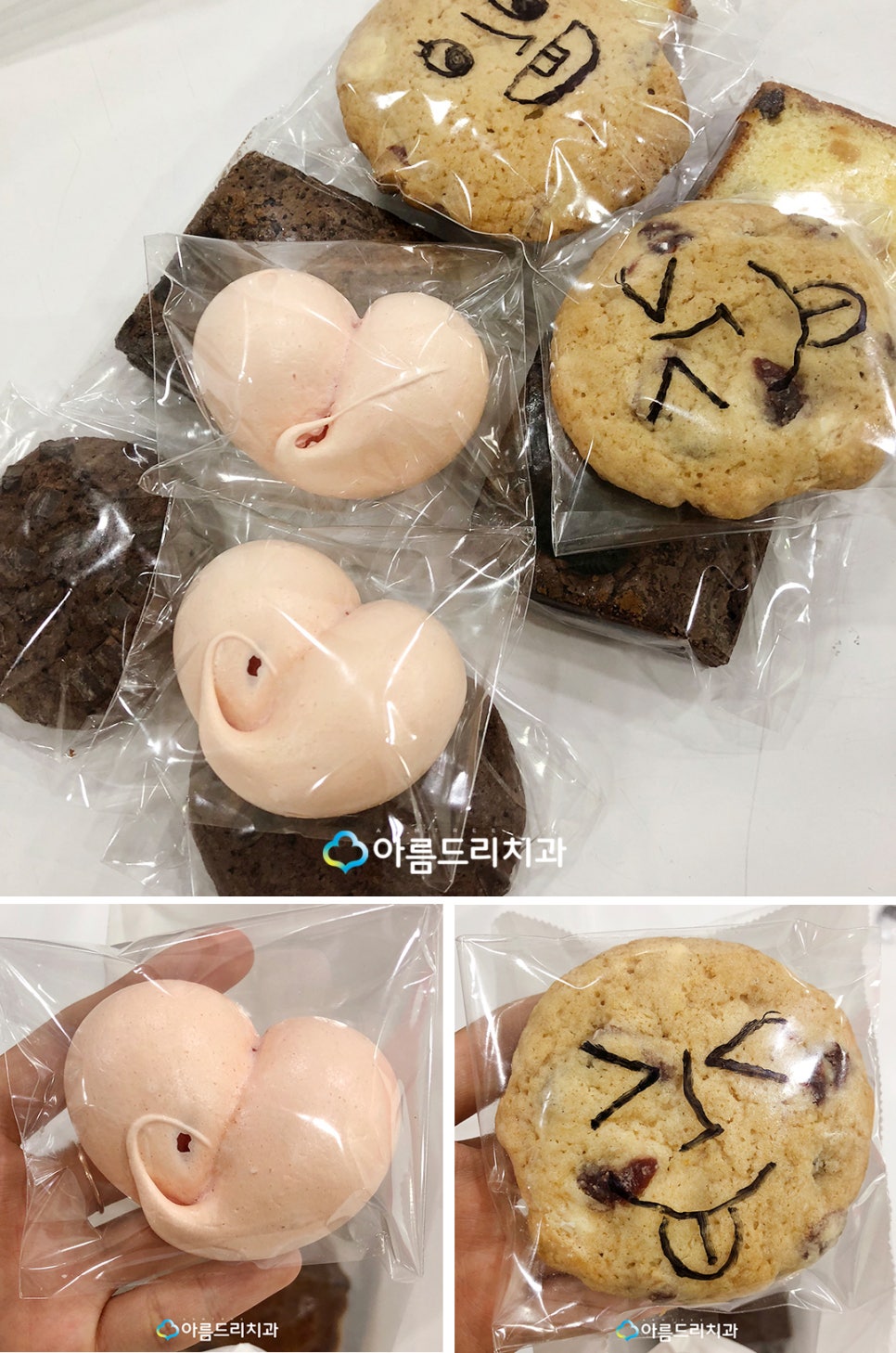 시린이 이시림치료 치경부마모증 관련 이미지 2