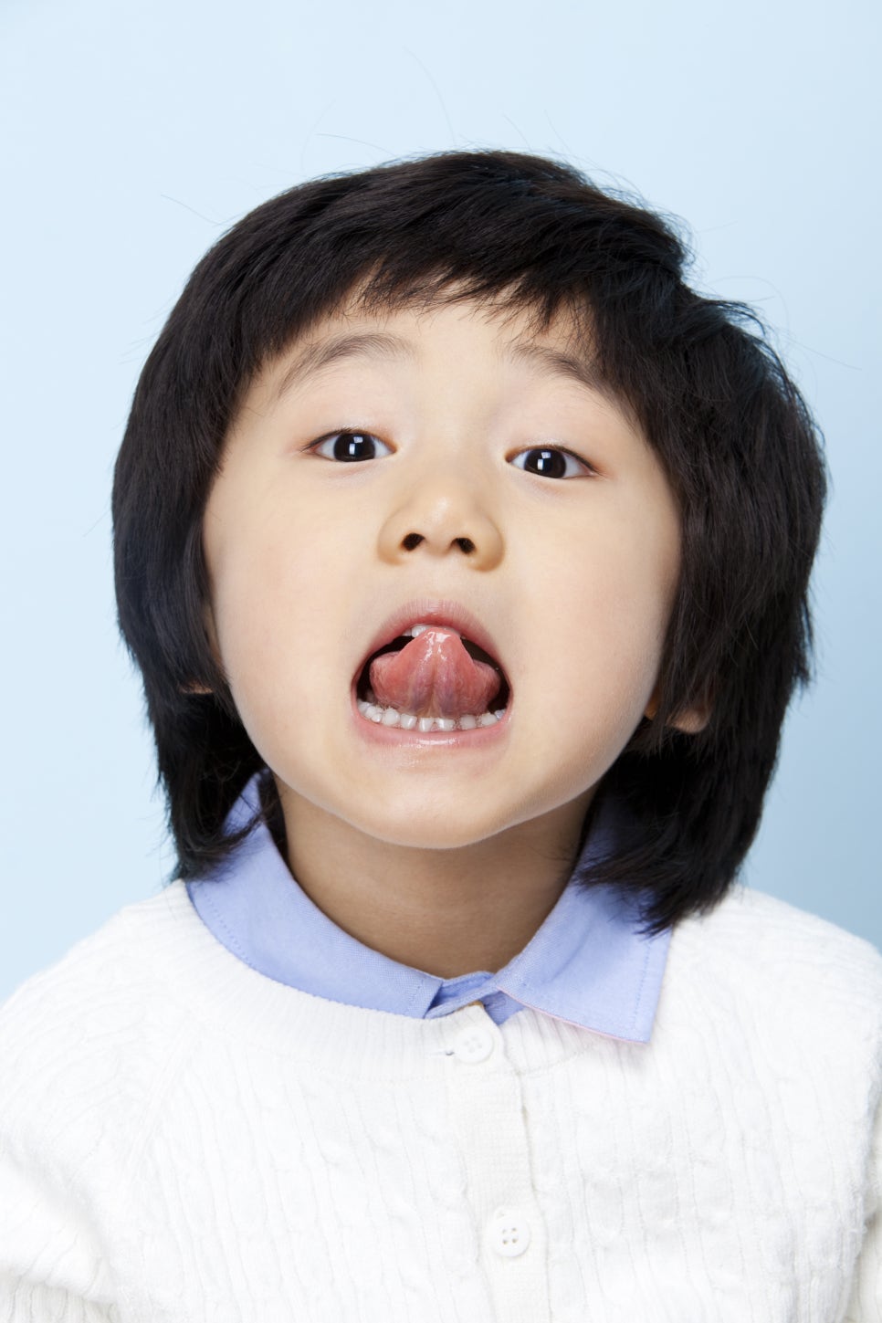 설소대 절제술로 발음 교정_레이저 시술로 빠른 치유 관련 이미지 2