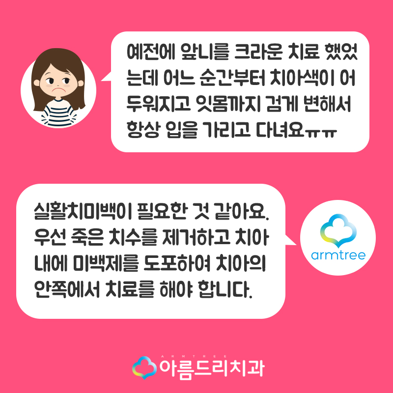 실활치미백 앞니 색깔 신경치료 치아변색 후기 관련 이미지 2