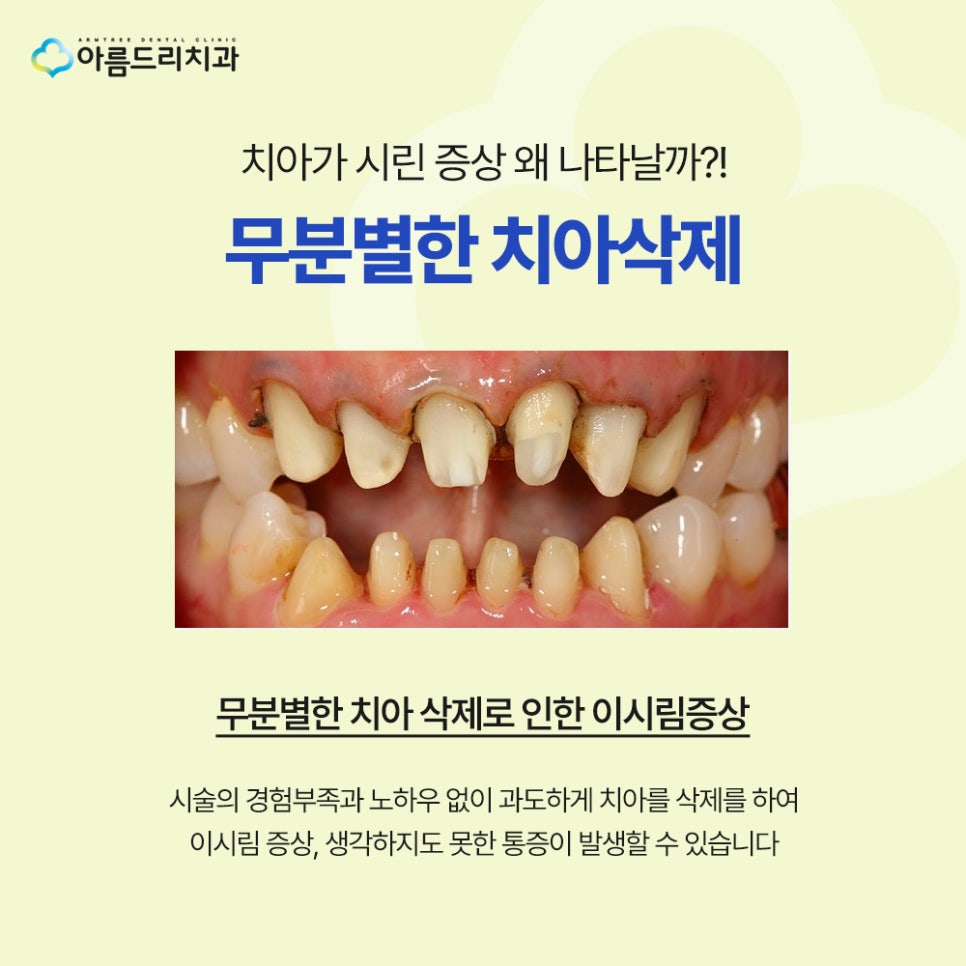 강남 라미네이트 부작용, 시림 현상, 깨짐, 탈락, 예방하는 방법 관련 이미지 4