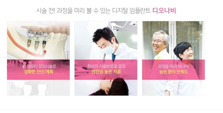 임플란트 보험적용 본인부담 50% 관련 이미지 4