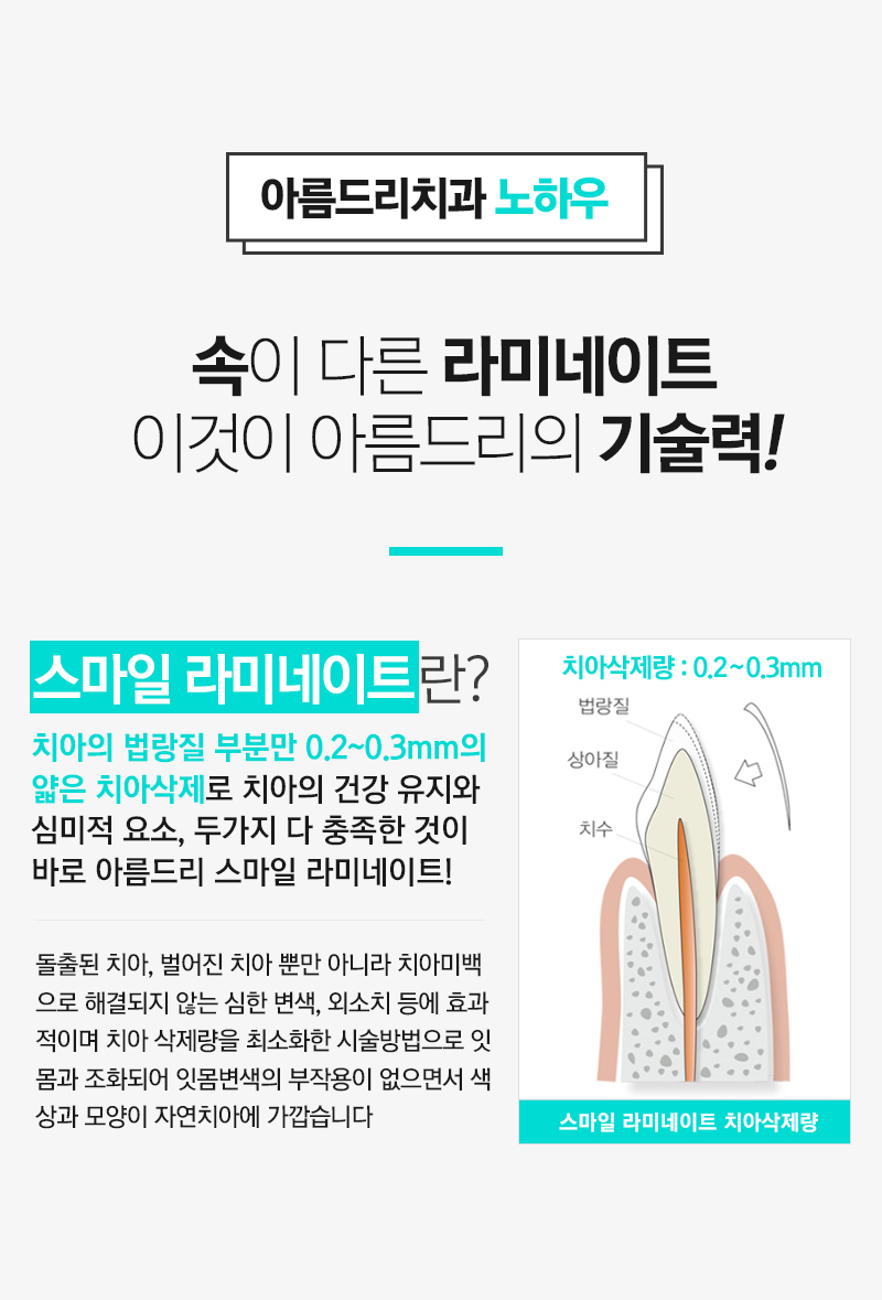 아름드리치과 속이다른 스마일라미네이트 관련 이미지 5