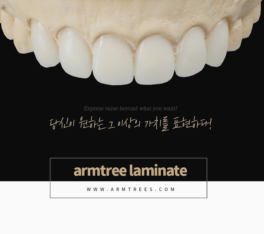 앞니라미네이트 후기가 많은 아름드리치과 관련 이미지 9