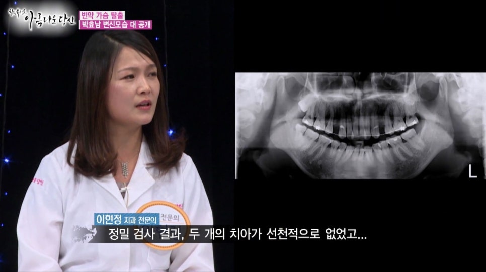 이현정원장의 아름다운 당신 시즌 1(4회 박효남 도전자) 돌출입 치아교정 관련 이미지 6