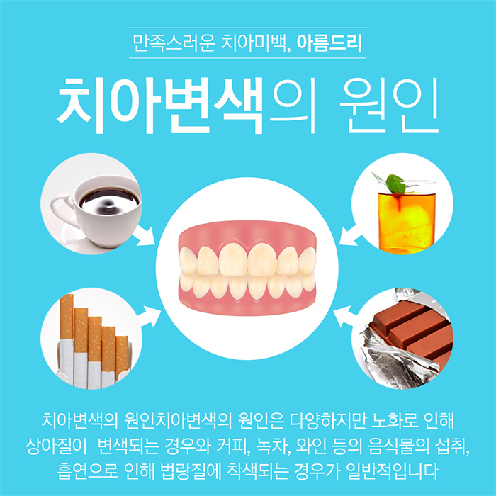 이빨미백 치과치아미백 결과의 차이 관련 이미지 3