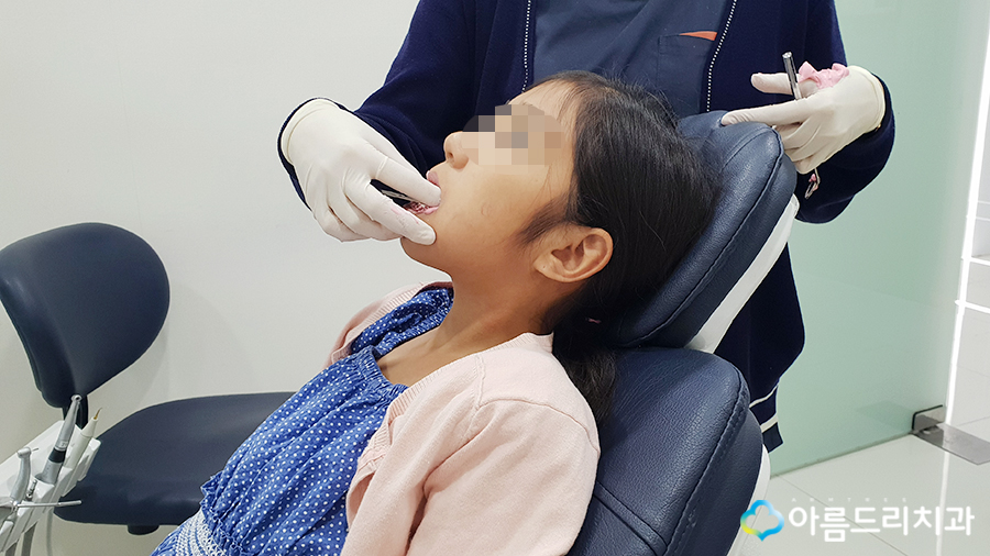 어린이치아교정 부정교합 리얼스토리#2 관련 이미지 4